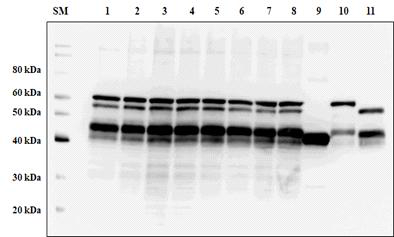 재조합 L. casei 에서 HPV 16형 E7과 HPV 18형 E7의 발현 확인