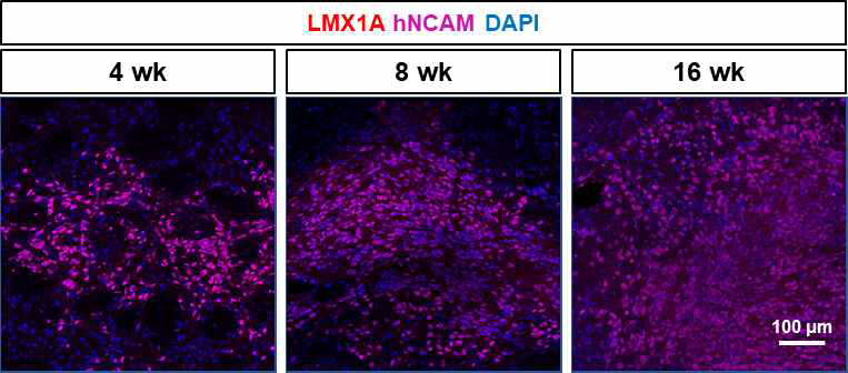 세포이식 후 경과시간에 따른 중뇌 도파민세포 마커인 LMX1A의 발현 확인