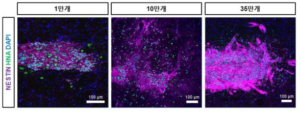 세포 이식 16주 후 이식편에서의 NESTIN 양성세포 확인