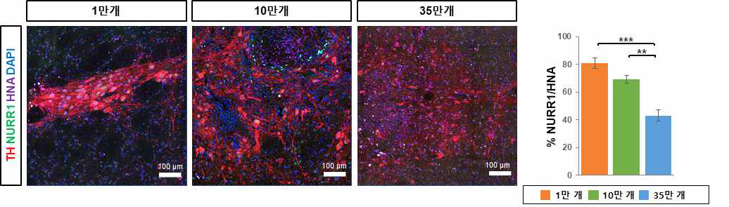 이식 세포 수에 따른 TH, NURR1 양성세포 비율 분석 (이식 후 16주)