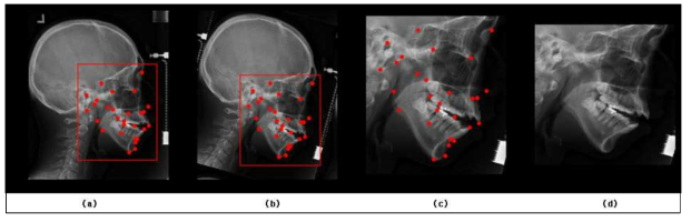 Lateral 영상 전처리 과정. (a) 원본 영상, (b) Sella와 Nasion 기준으로 Rotation, (c) (b)를 기준으로 Crop한 영상, (d) Resize한 영상