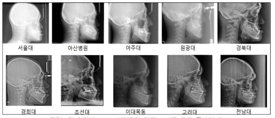 각 기관별 X-ray 이미지가 가지는 서로 다른 특성의 예