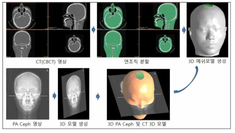 CT 영상 및 PA-Ceph 영상의 3차원 모델 변환의 예