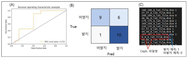 (A): 테스트 결과의 AUROC. (B): 테스트 결과의 confusion matrix. (C): 테스트 결과로 저장되는 result.txt파일의 예시