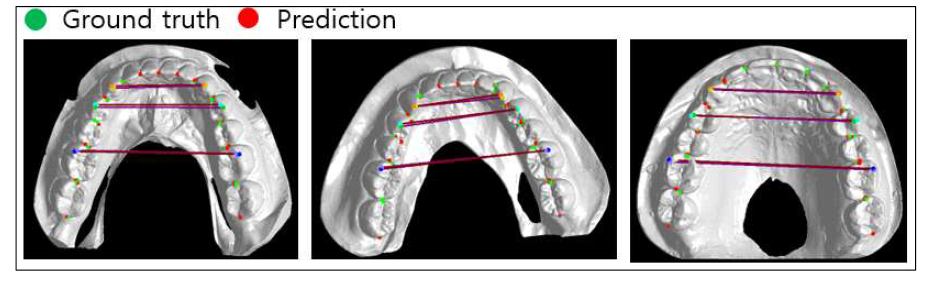 인공지능 기반 치아 랜드마크 검출 결과 예제