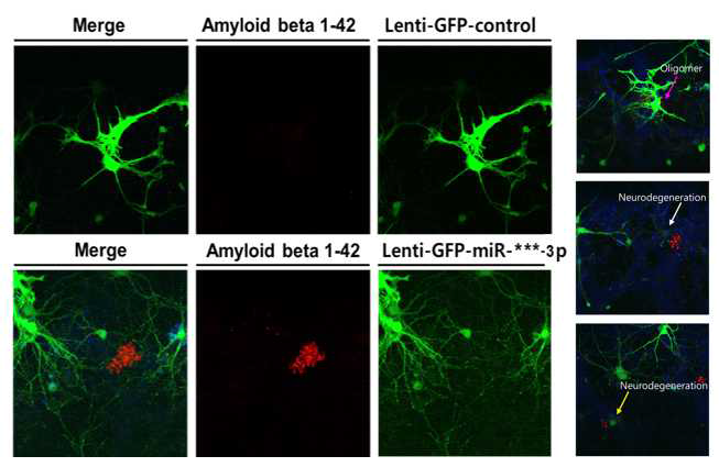 miR-***3p 과발현이 아밀로이드 베타 생성에 미치는 영향