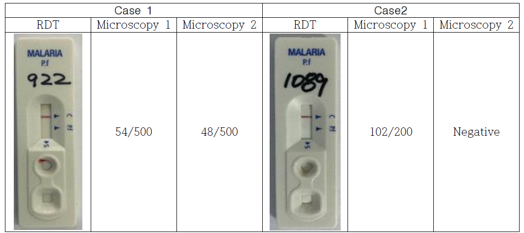 위음성 (RDT음성, Microscopy양성)