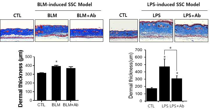 전신경화증 마우스모델에서 항생제 처리에 따른 피부경화증 억제 효과. *P < 0.05 vs CTL