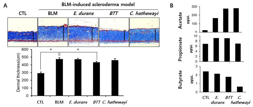 A. BLM-induced scleroderma model에서 E. durans, B. thetaiotmicron, C. hathewayi의 피부경화증 억제 효능 평가. B. 인체미생물 배양액 내 SCFA 농도 측정. *P < 0.05