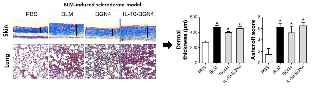 BLM-induced scleroderma model에서 BGN4 및 IL-10 producing BGN4의 피부 및 폐섬유화 억제 효능