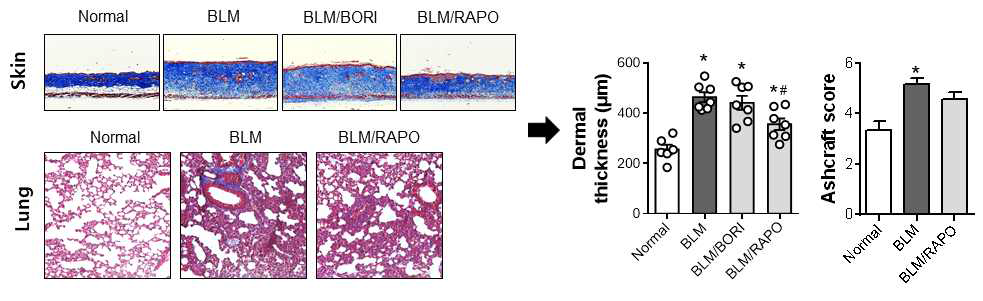 BLM-induced scleroderma model에서 BORI 및 RAPO의 피부 및 폐섬유화 억제 효능 평가. *P < 0.05 vs Normal, #P < 0.05 vs BLM