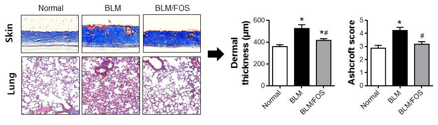 BLM-induced scleroderma model에서 FOS의 피부 및 폐섬유화 억제 효능 평가. *P < 0.05 vs Normal, #P < 0.05 vs BLM