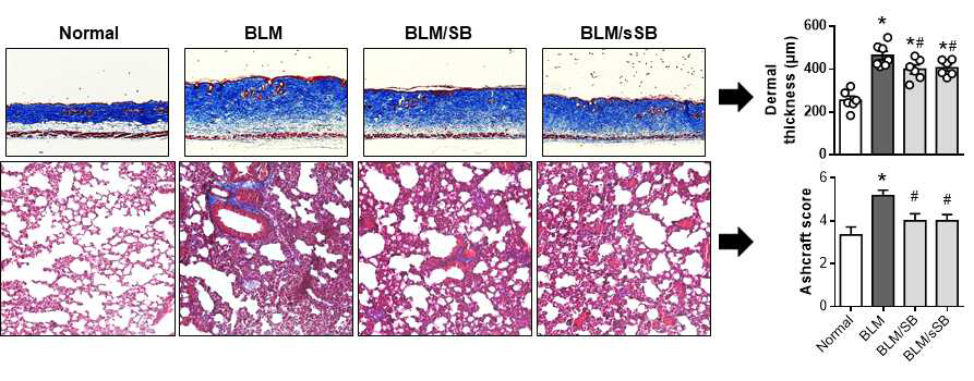BLM scleroderma model에서 slow releasing SB에 의한 피부 및 페섬유화 억제 효능 검증. *P < 0.05 vs Normal, #P < 0.01 vs BLM
