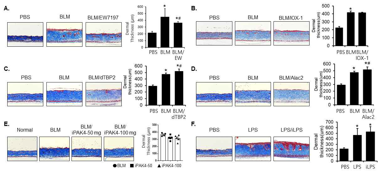 BLM 또는 LPS scleroderma model에서 EW7157 (A), IOX-1 (B), dTBP2 (C), Alac2 (D), PAK4 inhibitor (E), LPS inhibitor (F)의 피부경화증 효능 평가. *P < 0.05 vs PBS, #P < 0.05 vs BLM