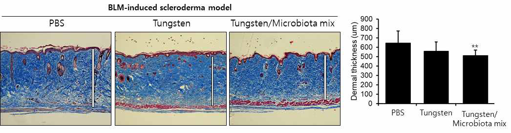BLM scleroderma model에서 Tungsten/제 1군 파마바이오틱스 조합에 대한 피부경화증 억제 효과