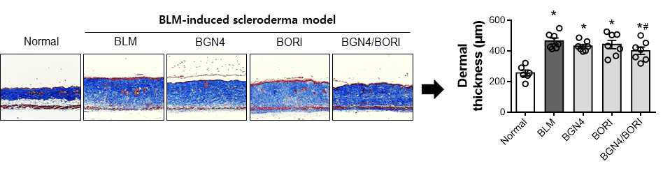 BLM scleroderma model에서 프로바이오틱스 조합에 대한 피부경화증 억제 효과 검증. *P < 0.05 vs Normal, #P < 0.05 vs BLM