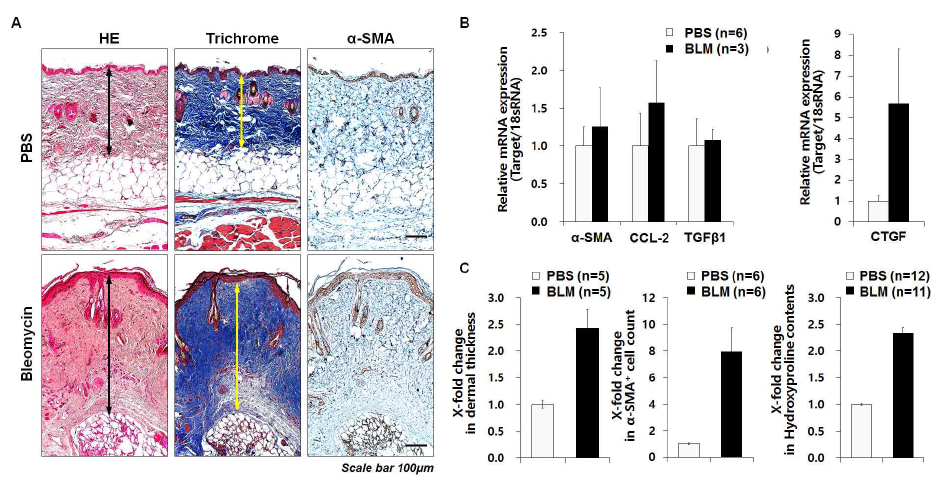 Evaluation of belomycin-induced fibrosis model. (A) Representative pictures of HE, Masson’s trichrome stain and immunohistochemistry targeted α -SMA. (B) Fibrosis-mediated transcripts expression in parallel with 18S RNA(C) Histological analysis by dermal thickness, hydroxyproline contents and α-SMA+ cell count in fibrosis skin