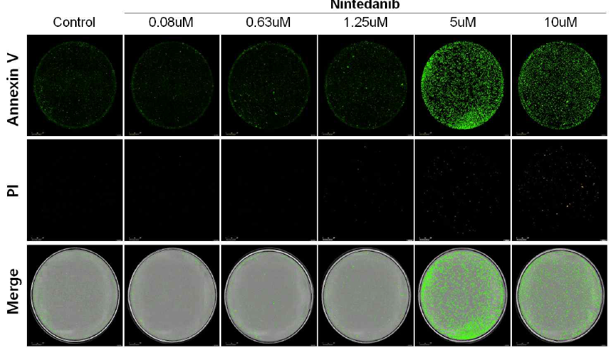 Apoptosis in dermal fibroblast in presence with nintedanib. Nintedanib treated cells were stained using Annexin V (green) and propidium iodide (red) and detected using incucyte