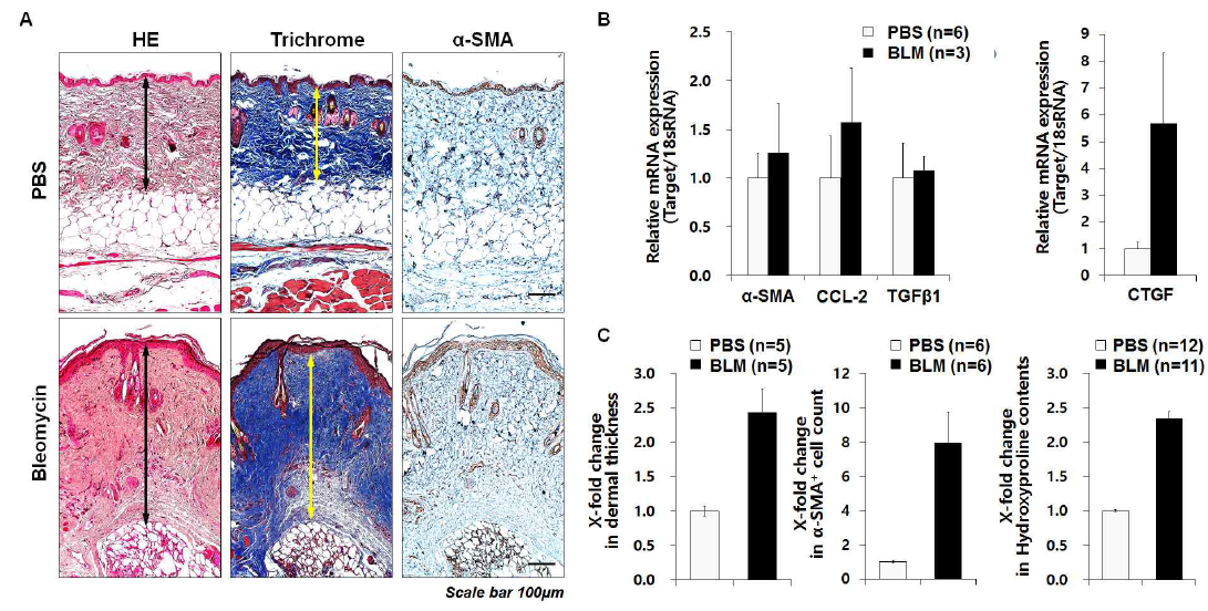 Evaluation of belomycin-induced fibrosis model. (A) Representative pictures of HE stain, Masson’s trichrome stain and immunohistochemistry targeted α-SMA. Scale bar is 100 μ m. (B) Transcripts were measured in parallel with 18S RNA and values are presented as mean of fold change transcripts ± SEM. (C) Histological analysis in belomyucin-induced fibrosis model by dermal thickness, hydroxyproline contents and α-SMA+ cell count in fibrosis skin. Data are presented as mean ± SEM. Abbreviation; α-SMA; α-Smooth muscle actin, PBS; phosphate buffered saline, BLM; bleomycin