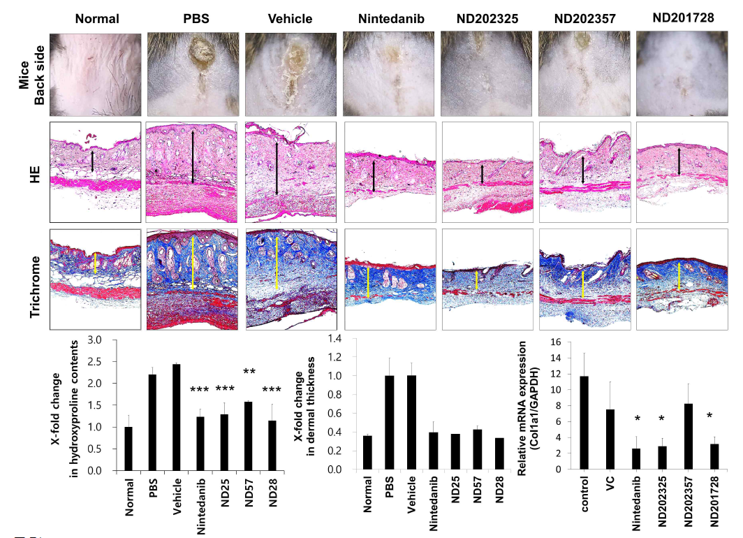 Histological analysis of PDGFR-targeted inhibitors terated BISF model. Upper, representative pictures of fibrosis skin tissues. Lower, quantification of collagen accumulation, dermal thickness, and transcript expression of fibrosis mediators