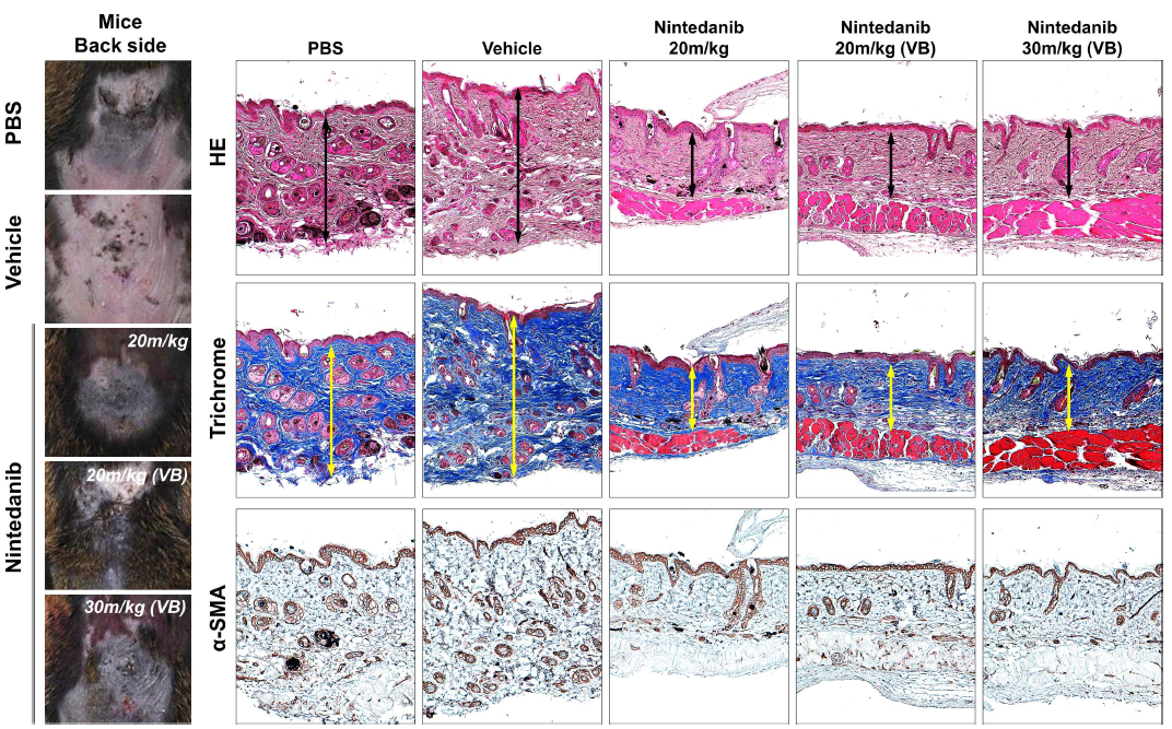 Clinical and histological analysis of therapeutic effect by oral administration of nintedanib in belomycin-induced fibrosis model