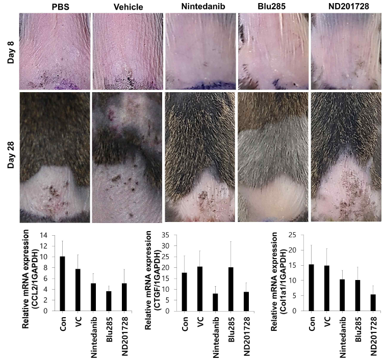 Evaluation of severity of fibrosis and quantification of fibrosis-mediator expression in ND201728 treated BISF model