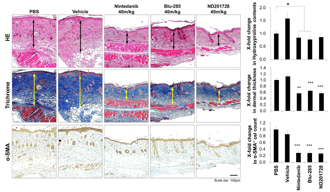 Histological analysis of ND201728 terated BISF model. Left, representative pictures of HE, Masson’s trichome and immunohistochemistry targeted α-SMA. Right, quantification of histological analysis in therapeutic effect of ND201728 by hydroxyproline contents, dermal thickness, α-SMA+ cell counts