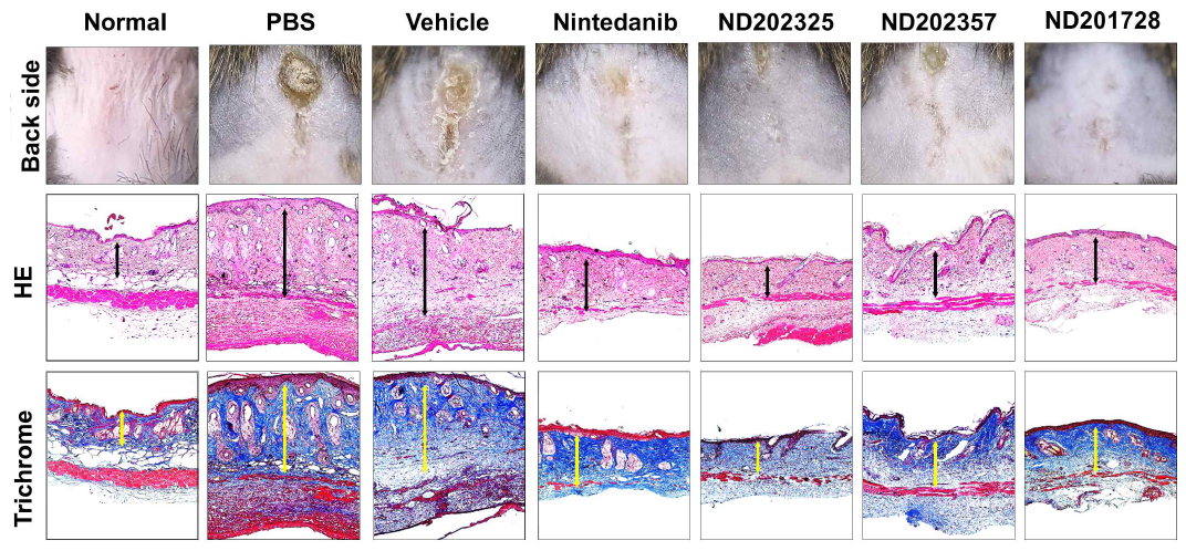 Representative pictures of clinical and histological analysis in PDGFR-targeted compounds (ND202325, ND202357,, ND201728) treated BISF model