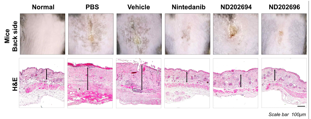 Representative pictures of clinical and histological analysis in PDGFR-targeted compounds (ND202694, ND202696) treated BISF model