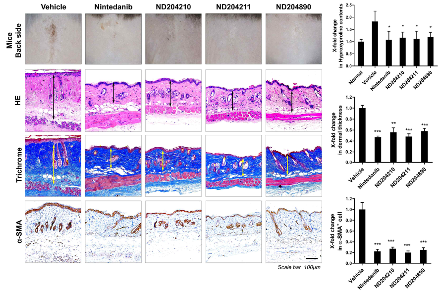 Histological analysis of ND204210, ND204211, ND204890 terated BISF model. Left, representative pictures of HE, Masson’s trichome and immunohistochemistry targeted α-SMA. Right, quantification of histological analysis in therapeutic effect of ND204210, ND204211, ND204890 by hydroxyproline contents, dermal thickness, α-SMA+ cell counts