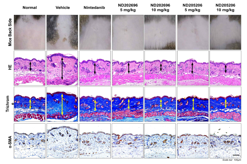 Representative pictures of clinical and histological analysis in PDGFR-targeted compounds (ND202696, ND205602) treated BISF model