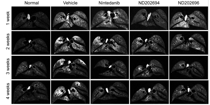 Qualitative and quantitative assessment of lung by micro-computed tomography (micro-CT)