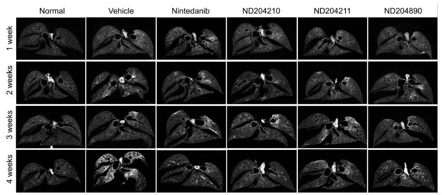 Qualitative and quantitative assessment of lung by micro-computed tomography (micro-CT)