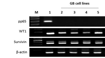 악성교모세포종 세포주에서의 pp65, WT1, Survivin 발현 확인