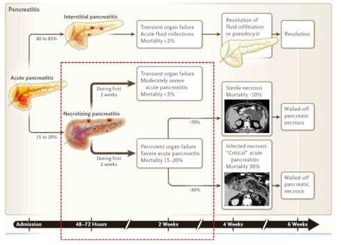 Time Course and Management of Acute Pancreatitis (NEJM, 2015)