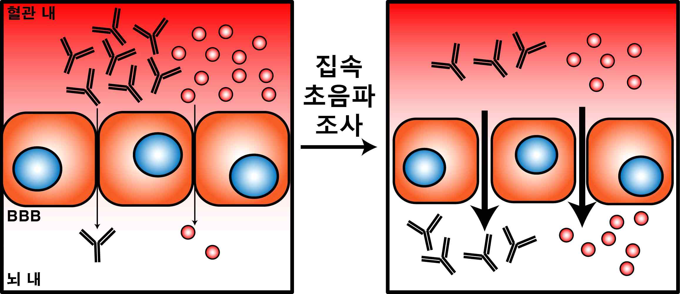 집속 초음파에 의한 치료 약물 및 항체 BBB 투과율 제어 및 조절 기전