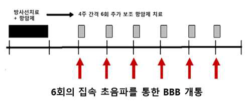 집속 초음파를 이용한 세계 최초의 뇌종양의 6회 BBB 개통 항암제