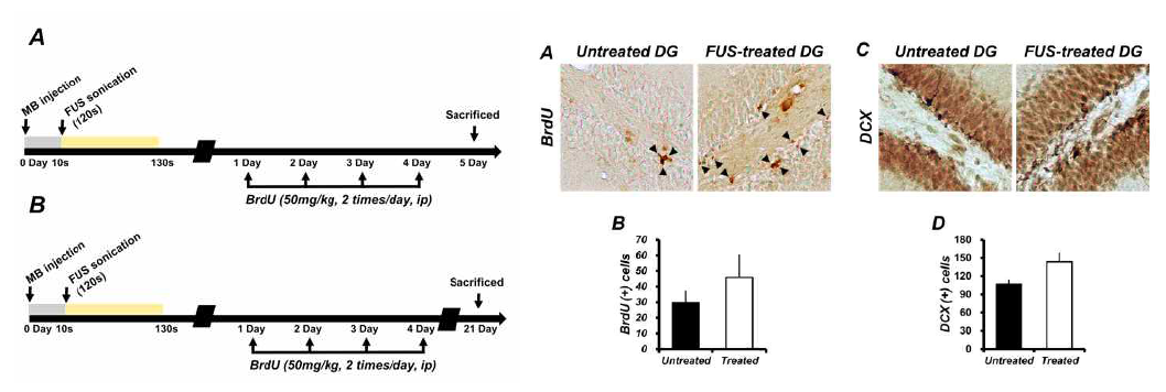 초음파 조사 24시간 후 BrdU 주입 후 BrdU 및 DCX 염색을 통한 신경 재생 확인