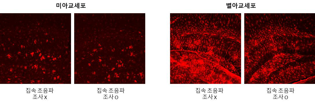 집속 초음파 단일 조사에 의한 미아교세포의 과활성화 감소