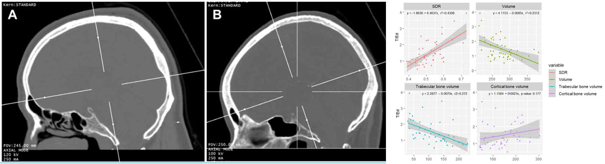 환자별 CT 이미지 및 두개골 요소별 두개골 투과 에너지 변화량 분석 결과