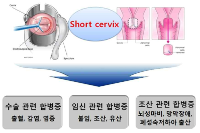 원추절제술에 의한 합병증들