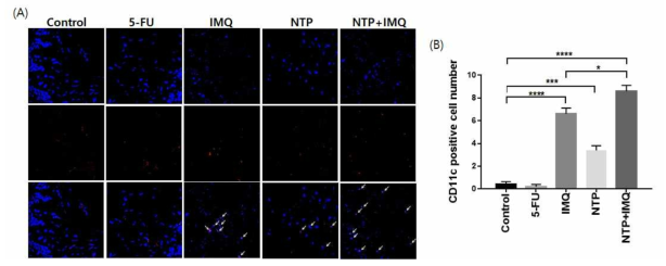 잔류 종양내 수지상세포 IF (Immunofluorescence) confocal 사진(A), 각 그룹별 CD11c positive cell 정량 그래프(B)