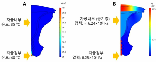 플라즈마 주입에 따른 자궁경부 및 자궁내부의 온도(A)와 압력(B) 변화 계산결과