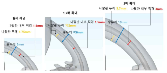 자궁내 나팔관 제작도 및 모형 크기에 따른 나팔관 크기 및 나팔관 벽 두께