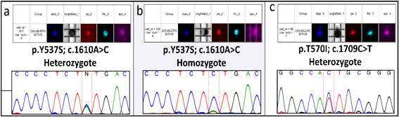 분리한 순환종양세포 단일 세포의 ESR1 mutation analysis (Clinical Cancer Research, 2017)