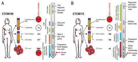 전이성 유방암의 Clinical time line과 순환종양세포의 개수 (Clinical Chemistry, 2015)