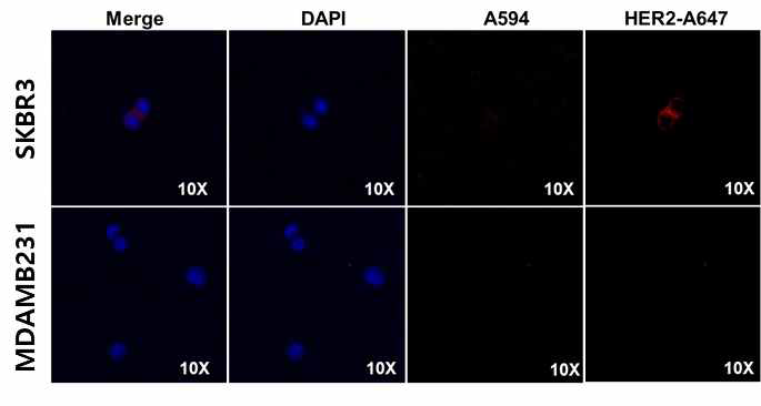 HER2 immunocytochemistry (ICC) 이미지