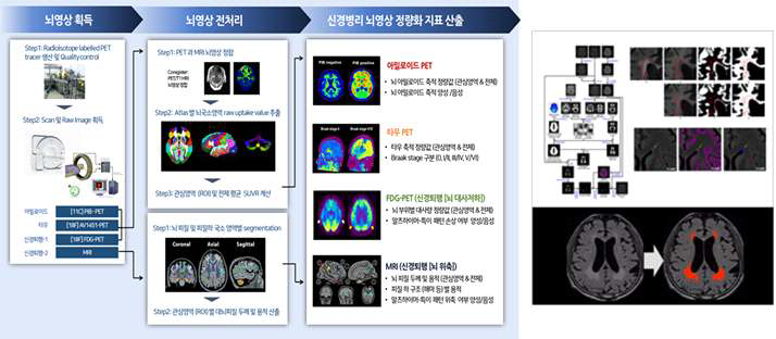 뇌영상 획득 및 전처리, 정량화 지표산출