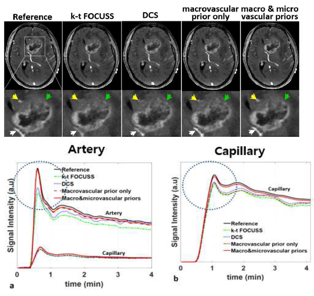 혈관계 특성에 따른 선별적 혈관계 신호 변화 영상 복원 결과