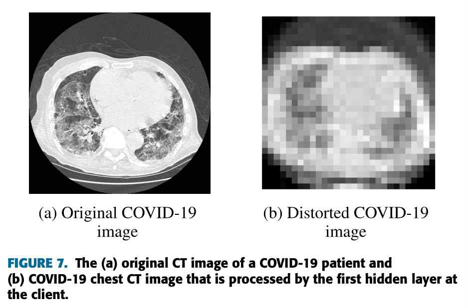 분할학습에 따른 COVID-19 이미지 처리와 프라이빗 데이터 보존